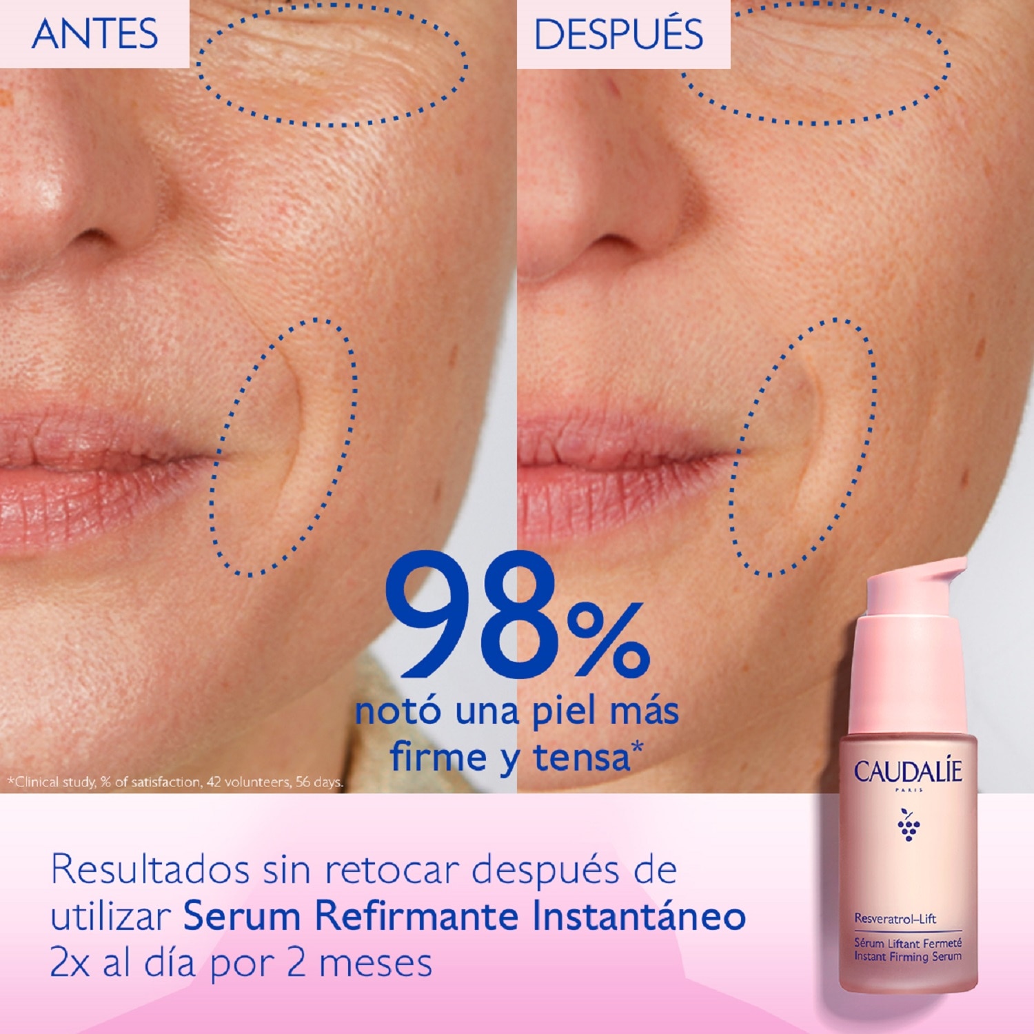 SERUM ALTERNATIVO AL RETINOL REAFIRMANTE INSTANTÁNEO RESVERATROL-LIFT (SERUM REAFIRMANTE)